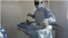 Dr. Tebeu prepares his instruments for the operation, Yaounde, Cameroon, June, 2014. (Moki Edwin Kindzeka/VOA)