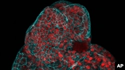This microscope image provided by researchers in March 2024 shows a lung organoid created from cells collected from amniotic fluid. (Giuseppe Calà, Paolo De Coppi, Mattia Gerli via AP)