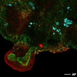 This microscope image provided by researchers in March 2024 shows an intestinal organoid with its distinctive 'bud' structure, created from cells collected from amniotic fluid.(Giuseppe Calà, Paolo De Coppi, Mattia Gerli via AP)