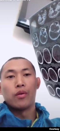 前中国“精神病监狱”受害者界立建2018年第三度遭精神病监禁后，出院后照的CT片。(照片提供：界立建)