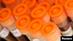 FILE - Test tubes filled with samples of bacteria to be tested are seen at the Health Protection Agency in north London.