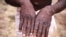 Sebuah gambar dari penyelidikan wabah cacar monyet di Republik Demokratik Kongo (DRC) sejak 1996 hingga 1997, menunjukkan tangan seorang pasien dengan ruam akibat cacar monyet. (CDC/Brian W.J. Mahy/Handout via REUTERS)
