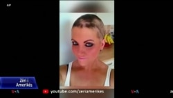 Sfidat e grave që vuajnë nga alopecia, sëmundja që shkakton rënien e flokëve