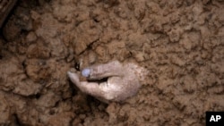 Dora e një kufome të varrosur në një varr masiv në qytetin Bucha, Ukrainë (3 prill 2022)