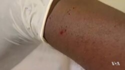 ባለሁለት ስለት መድኃኒት ወባን ለማጥፋት