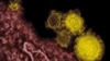 Mountain Laboratories shows novel coronavirus particles, also known as the MERS virus, colorized in yellow. 
