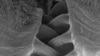The gears of the Issus insect are seen under a microscope. (Cambridge University)