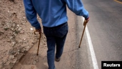 FILE - Muscular dystrophy causes muscles to weaken and wither. New research shows a potential cure for Duchenne muscular dystrophy, which affects one to 5,000 boys worldwide.