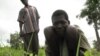A laborer tends to a field in the Central African Republic, despite his affliction with river blindness. (File)