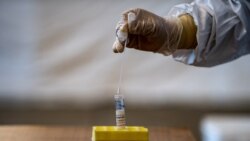 ኮቪድ-19 በኢትዮጵያ