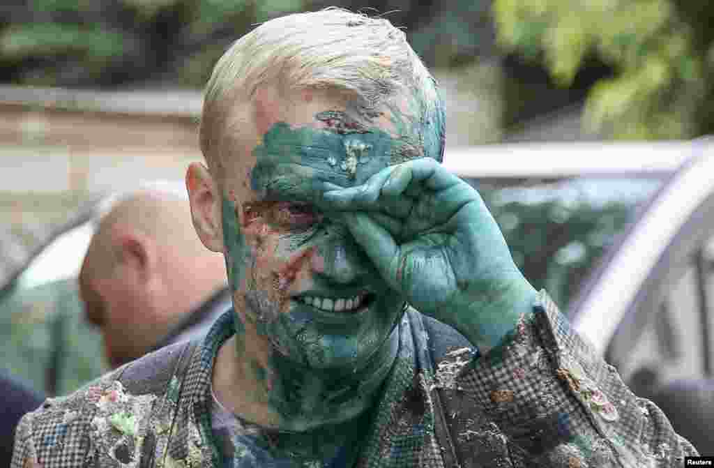 Vitaliy Shabunin, head of the non-governmental Anti-Corruption Action Center, reacts after he was splashed with a green substance during a rally in front of the Specialized Anti-Corruption Prosecutor's Office in Kyiv, Ukraine.