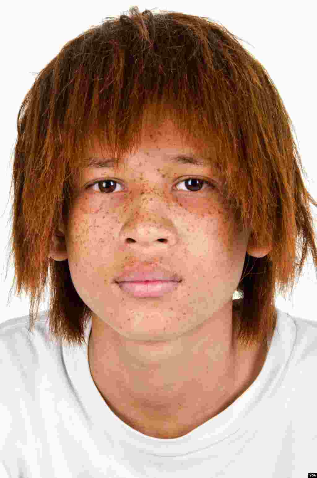 Remaja berdarah campuran yang berambut merah. (Foto: A. Pokroy)