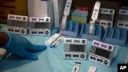 Mtaalamu wa maabara akipima sampuli za damu kuangalia maambukizi ya HIV katika Taasisi ya Afya ya Uzazi na HIV, Johannesburg, Nov. 26 2020.(AP Photo/Denis Farrell)