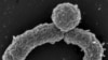 Newly discovered bacterium Eleftheria terrae makes an antibiotic that could be a new weapon against resistant infections. (William Fowle/Northeastern University)