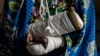 Alphonsime Mojetha (54) recovers in a hospital room, March 2, 2018 in Bunia, DRC, after an attack on her village where she lost her two children, and received severe lacerations to the back of her head, arms and hands from a machete attack.