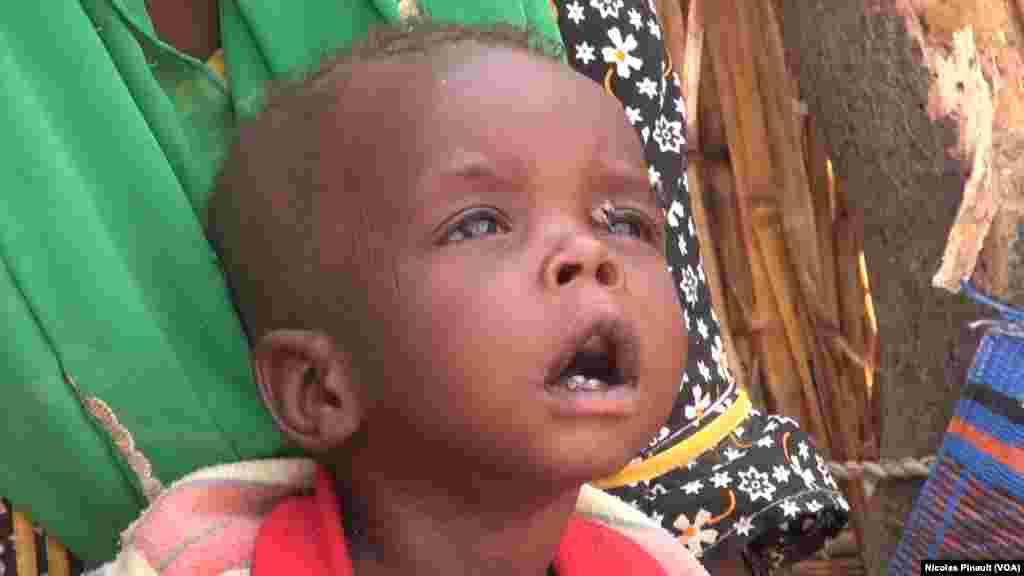 Mamadou da kyar ya kai kwatankwacin nauyin kilo 11 a sansanin Assaga dake Diffa