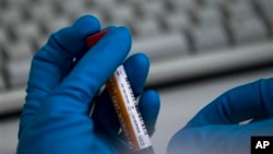 俄罗斯国家药品检测实验室的一名工作人员手持一个样本瓶。（资料照片）