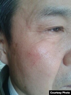 程海律师被打(图片来源：梁小军律师推特)