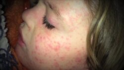 美总统大选揭开序幕 疫苗中注入政治色彩