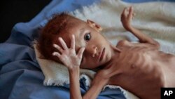 Ana fama da Yunwa a Yamal