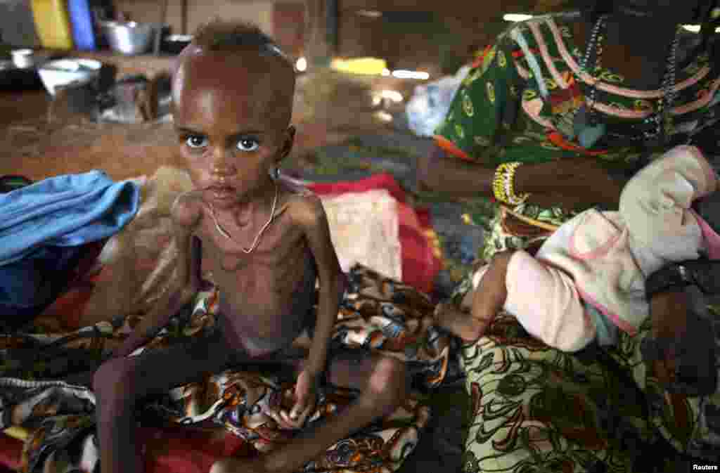 Seorang anak perempuan yang sakit dan kurang gizi duduk di sebelah ibunya yang tengah menyusui bayi di kota Boda, Uganda.