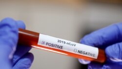 ኣብ ኤርትራ ፈላማይ ብኮሮና ዝተታሕዘ ሰብ ምርኻቡ ተገሊጹ