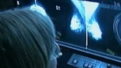 A researcher studying breast cancer