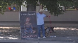 Lembaga Kesehatan Reproduksi AS Perdagangkan Janin?