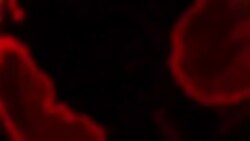 TASKAR VOA: Tsohon shugaban kasar Nijar Mohamane Ousmane ya yi tsokaci akan matsalar tsaro da kasar ke fama da ita, a wata hira ta musanman