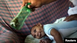Seorang anak yang lahir dengan microcephaly, di Olinda, dekat Recife, Brazil, 11 Februari 2016. 
