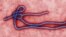 FILE - This undated file image made available by the CDC shows the Ebola Virus.