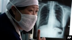 결핵 의심 환자의 흉뷰 X-레이 사진. (자료사진)