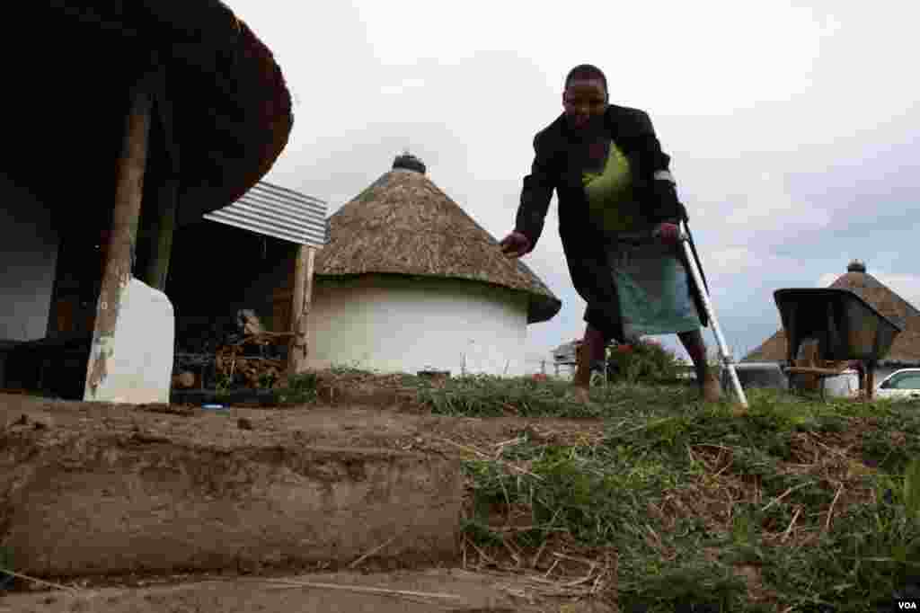 Lumka must walk with the aid of a crutch, but she often falls and hurts herself. (VOA/ D. Taylor) 