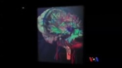 ဦးနှောက်ကို အဖြေရှာမယ့်စက်