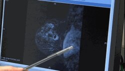 "پالبوسی‌سی‌لیب" یک ترکیب بازدارنده است و آنزیم‌هایی را که موجب تقسیم سریع تومور می شود، هدف می‌گیرد.