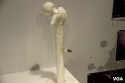 香港六四纪念馆展出从六四学生活动人士张健腿部取出的子弹 （美国之音记者申华拍摄）