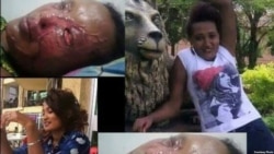 የአሲድ ጥቃት ያደረሰው ወንጀለኛ ተፈረደበት