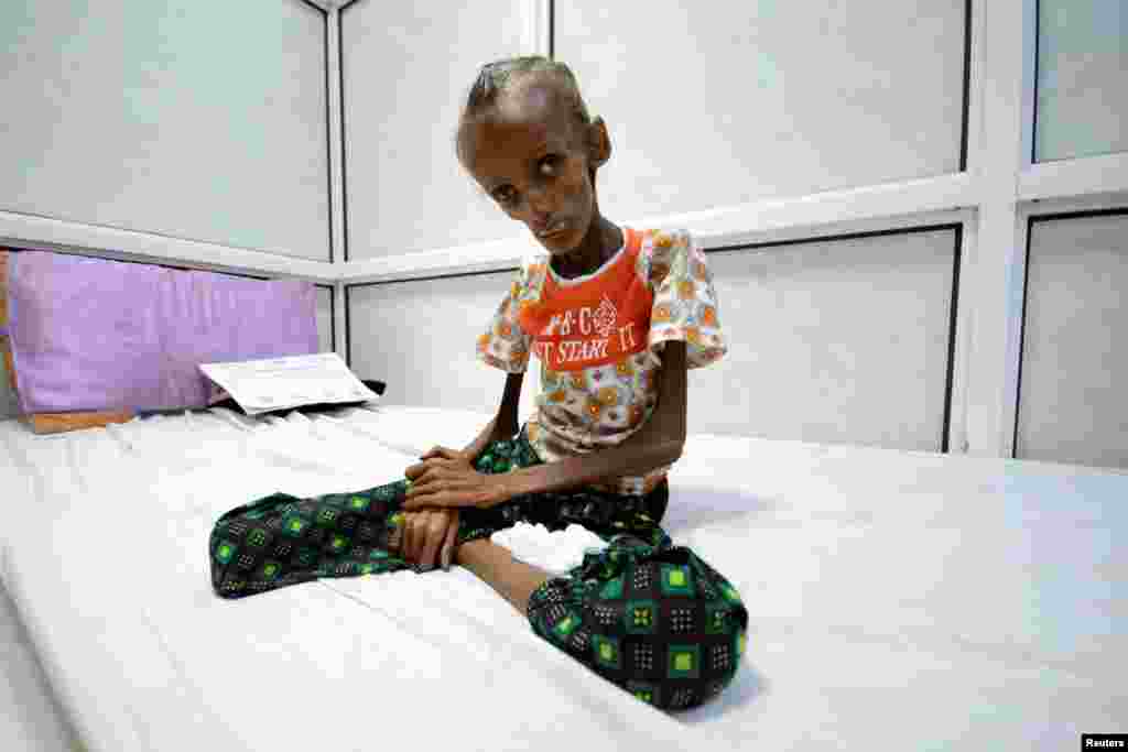 Saida Ahmad Baghili, 18, who is affected by severe acute malnutrition, sits on a bed at the al-Thawra hospital in the Red Sea port city of Houdieda, Yemen.