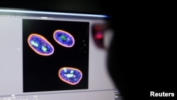 A researcher observes image on a screen showing the nucleus of human stem cells after KAT7 intervention, in the Aging and Regeneration lab at the Institute for Stem Cell and Regeneration of the Chinese Academy of Sciences (CAS) in Beijing, China, January