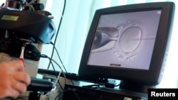 تصویر از جریان القاح مصنوعی تخمه با سپرم در لابراتوار