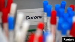 资料照：德国科隆一家医学实验室的冠状病毒检测试剂。（2020年3月24日）