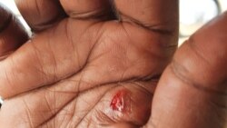 Ingxoxo Esiyenze LoMnu. Joseph Tshuma