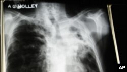 تپ دق ویکسین تجرباتی مراحل میں