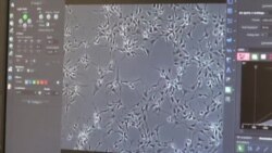 تکنولوژی در خدمت تماشای فعالیت سلول های مغز و اعصاب