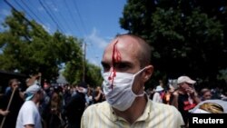 美国维吉尼亚州夏洛特维尔爆发白人至上主义者与反示威者的冲突，一名男子受伤。（2017年8月12日）