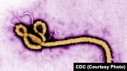 Mfano wa kirusi cha ugonjwa wa Ebola.