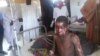 In this photo taken with a mobile phone, a man receives treatment at Konduga specialist hospital, following an attack by suspected Islamic extremists in Kawuri, Maiduguri, Nigeria, Tuesday, Jan. 28, 2014. At least 85 residents of Kawuri village in Nigeria