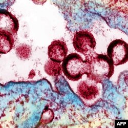 Alimlər HİV virusuna qarşı vaksin ixtira etmək üzrədir (audio)