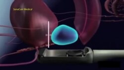 نخستین جراحی پروستات با ربات در آمریکا