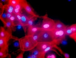 FILE - This undated fluorescence-colored microscope image made available by the National Institutes of Health in September 2016 shows a culture of human breast cancer cells.